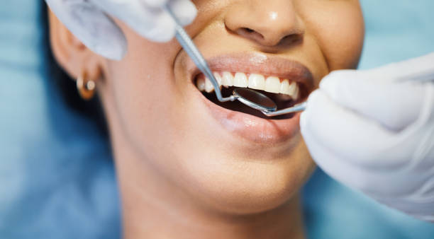 Best Emergency Wisdom Teeth Removal in Calverton, MD