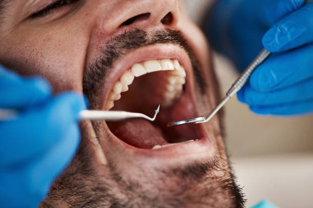 Best Emergency Treatment for Toothache in Calverton, MD