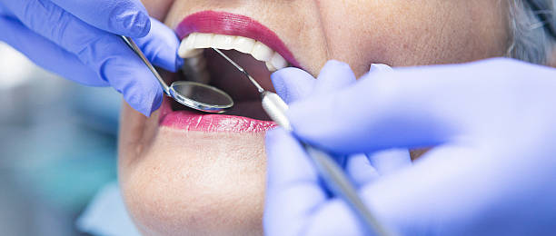 Best Emergency Tooth Extraction in Calverton, MD